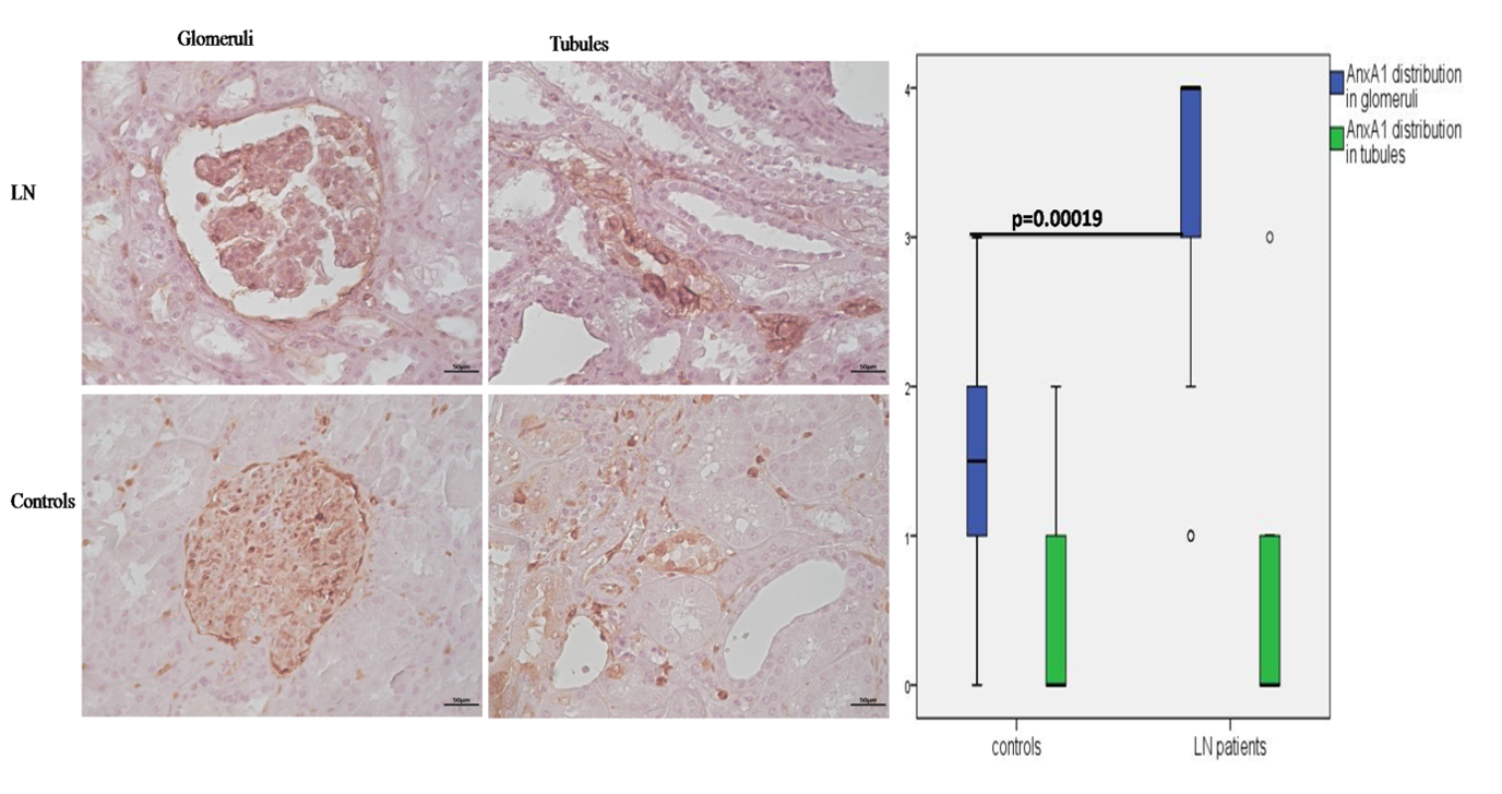 Figure 1: Immunohistochemical staining of AnnexinA1 in kidney tissues
