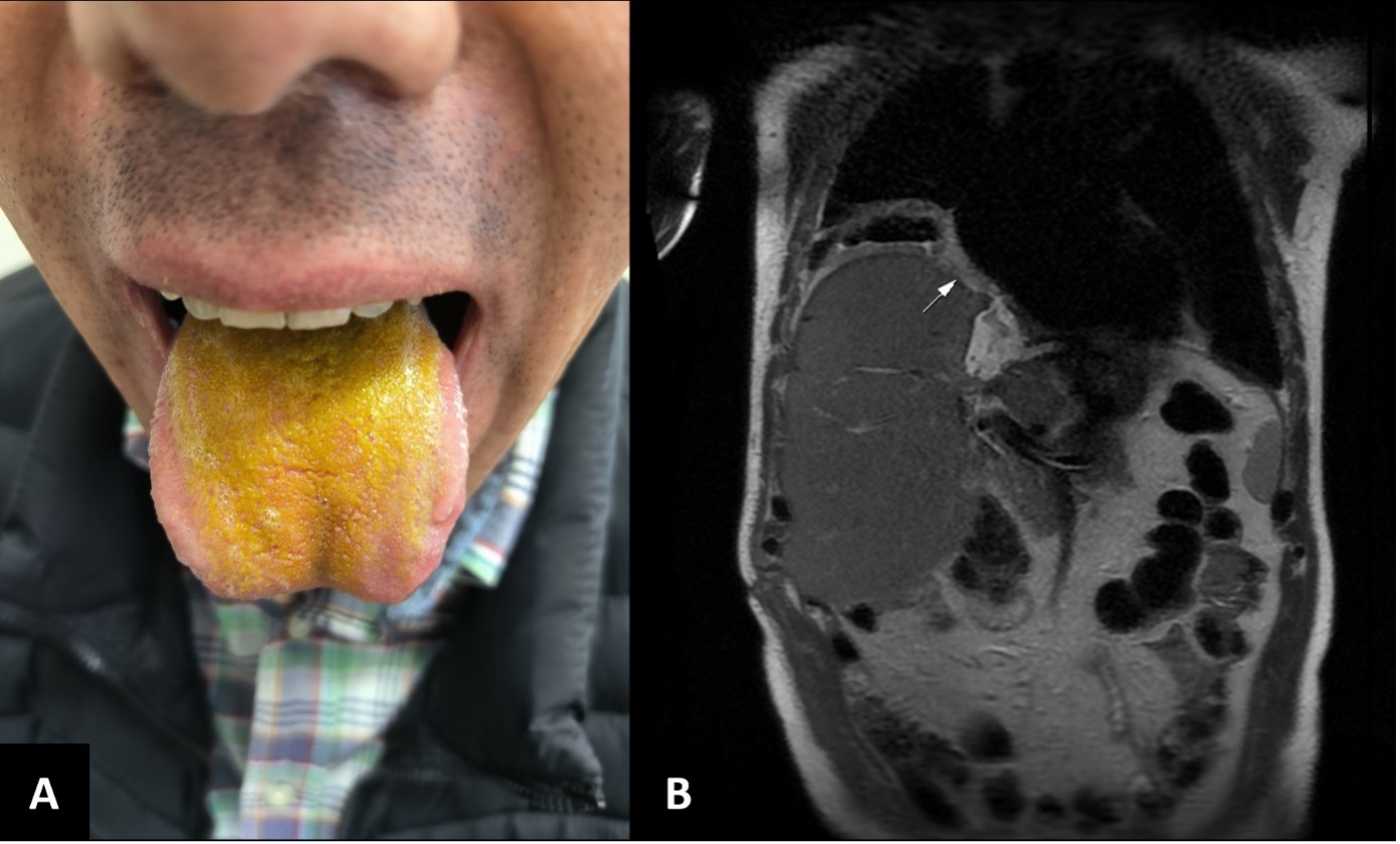 Fig 1.