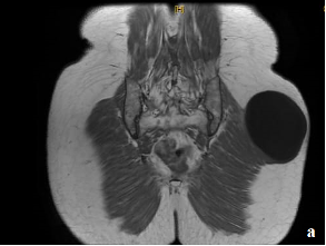 Fig 1.